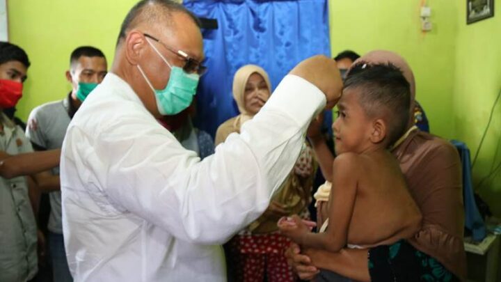 Akhyar Terharu Melihat Kondisi Anak Penderita Kelainan Fisik